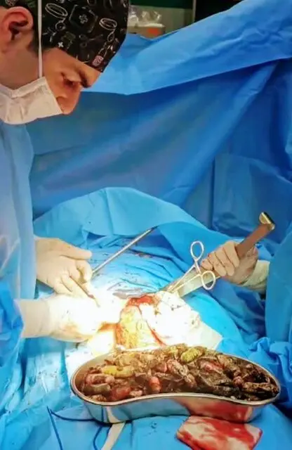 مواد مخدر معده