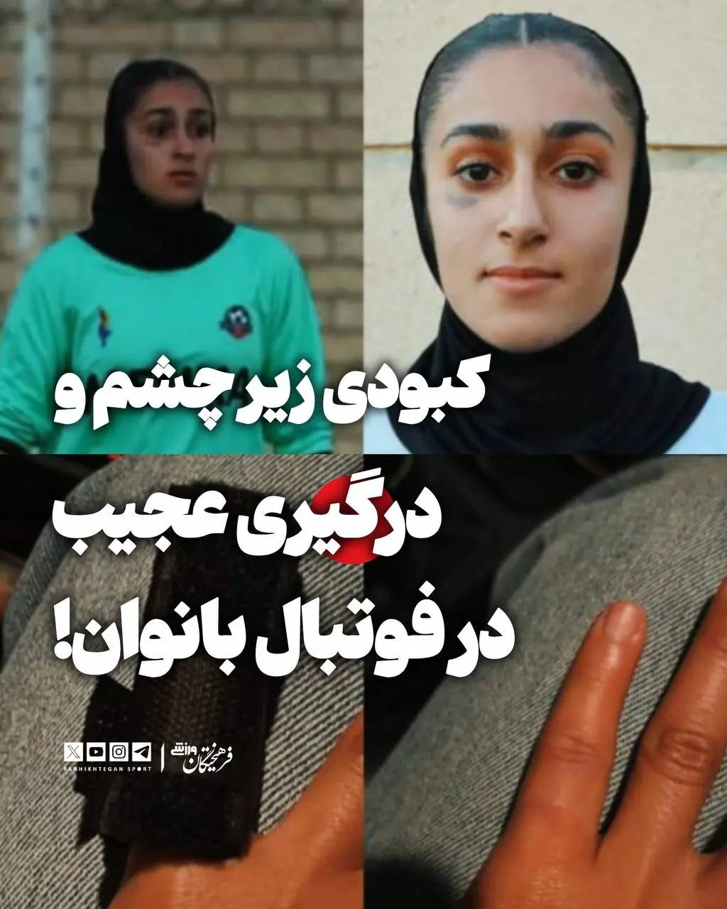 فرا ایساتیس کبودی چشم