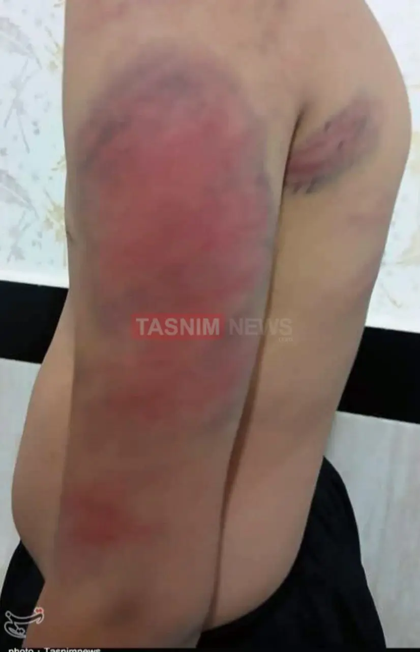 تنبیه بدنی