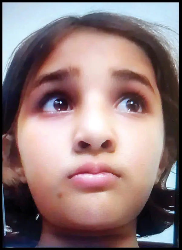 مرگ دردناک دختر 6 ساله اسکیت‌سوار