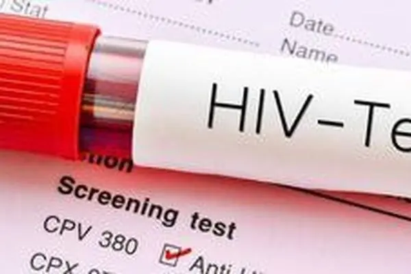 آخرین وضعیت HIV در کشور؛ درگیری ۸۱ درصدی مردان نسبت به درگیری ۱۹ درصدی زنان در موارد کلی