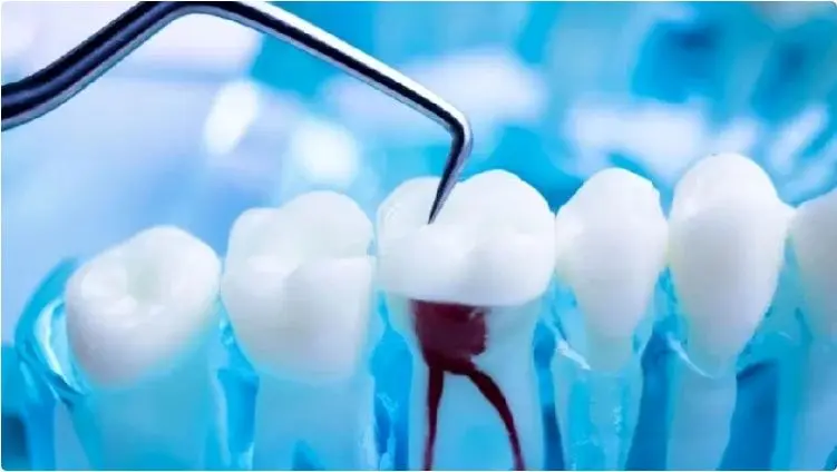تکنولوژی های نوین در دندان پزشکی ترمیمی