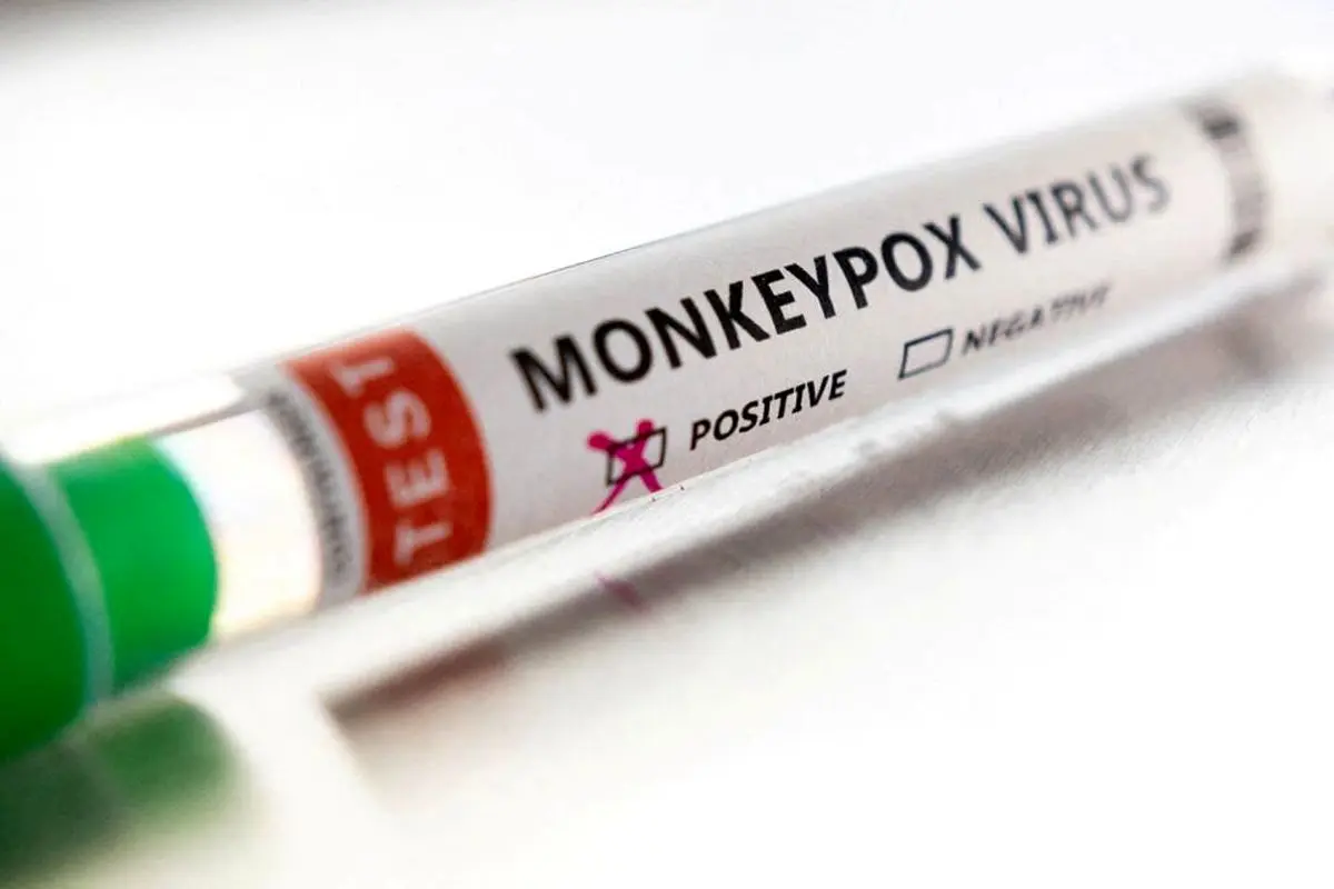 درخواست خرید واکسن آبله میمونی را دادیم؛ در حال بررسی است