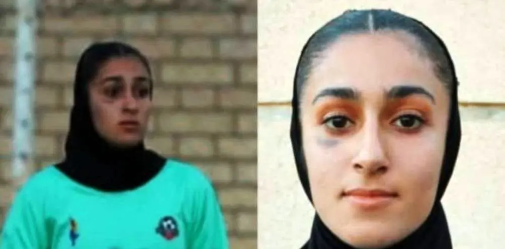 دختر پرسپولیسی زیر چشم بازیکن حریف را کبود کرد!