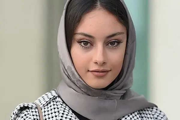 تصویری شوکه کننده از تغییر چهره ترلان پروانه بازیگر سریال هوش سیاه + عکس