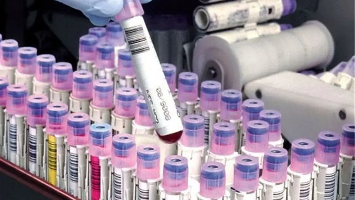 ایران صاحب ارزان ترین ذخیره‌گاه خون بندناف دنیاست