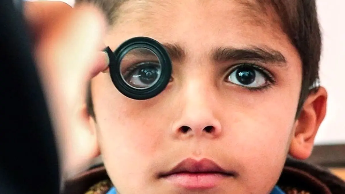 آغاز طرح سراسری پیشگیری از تنبلی چشم کودکان/ پیشگیری از نابینایی در 3 سالگی