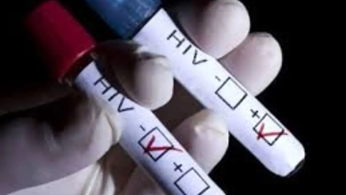آزمایش HIV قبل از بازی پرسپولیس و تراکتورسازی