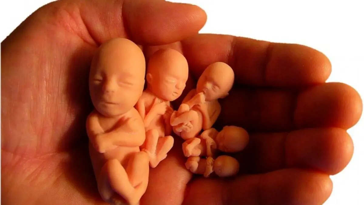 پارلمان ایرلند به قانونی شدن سقط جنین رای داد