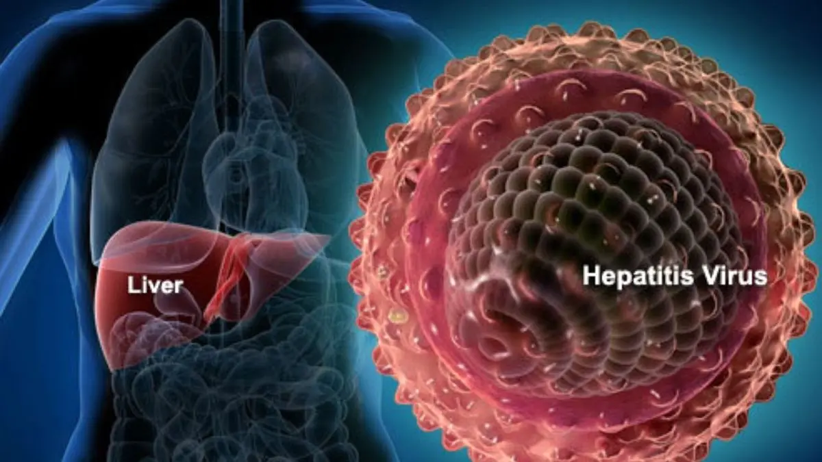 ویروس HBV بیش از HIV قربانی می‌گیرد