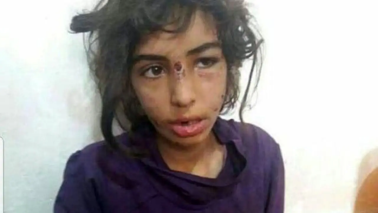 آخرین وضعیت کودکان شکنجه‌شده ماهشهری