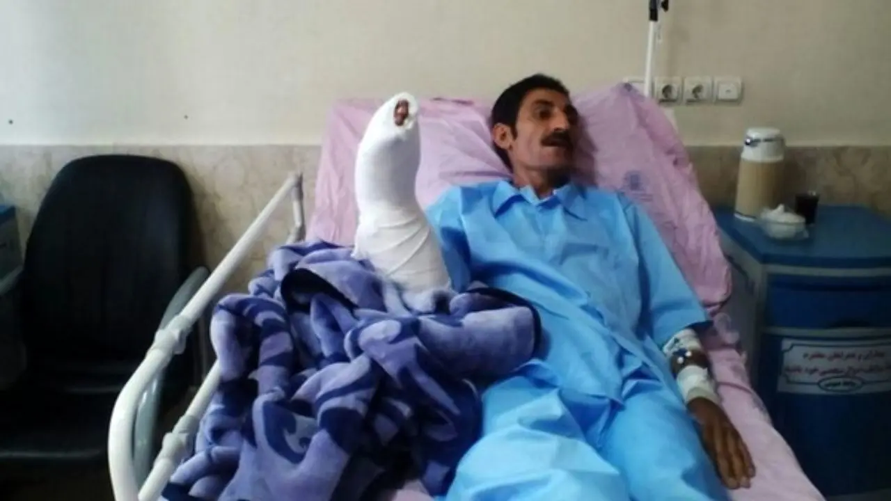 پیوند دست قطع‌شده از ساعد در بیمارستان شهدای عشایر