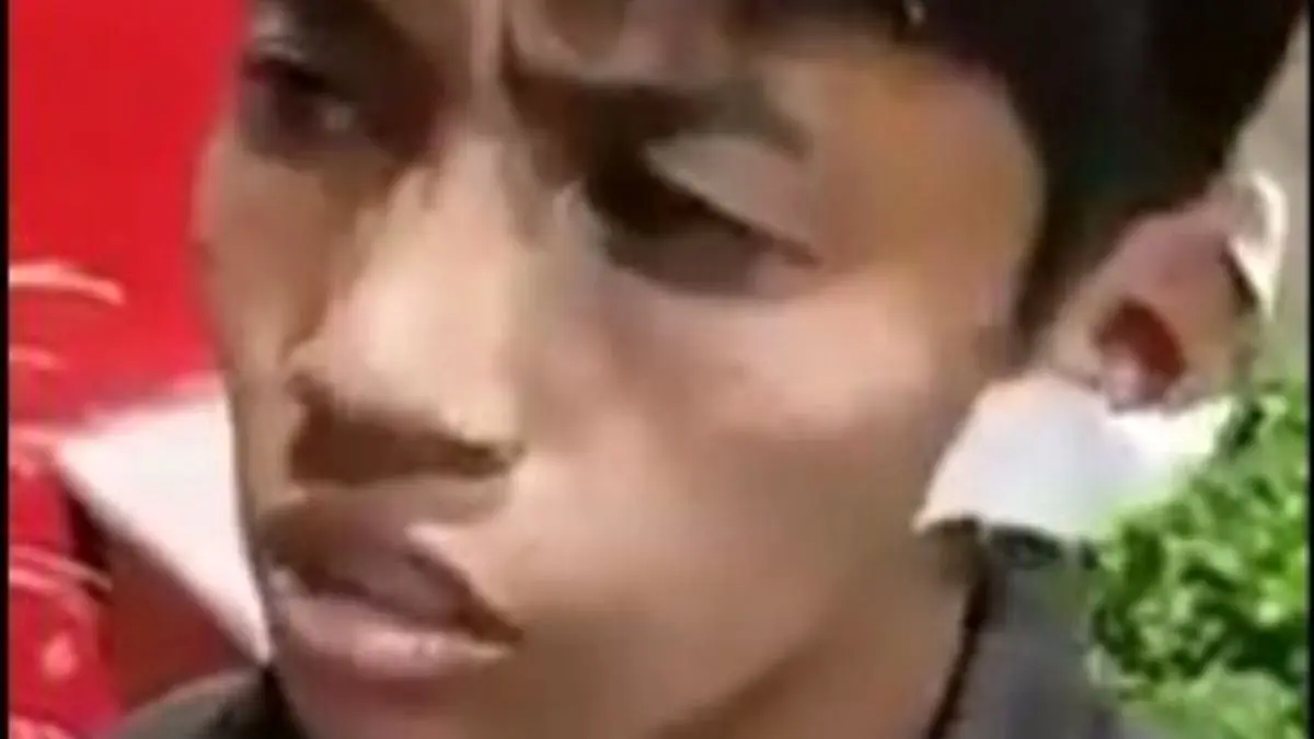 شهرداری بدنبال کودک گوش بریده