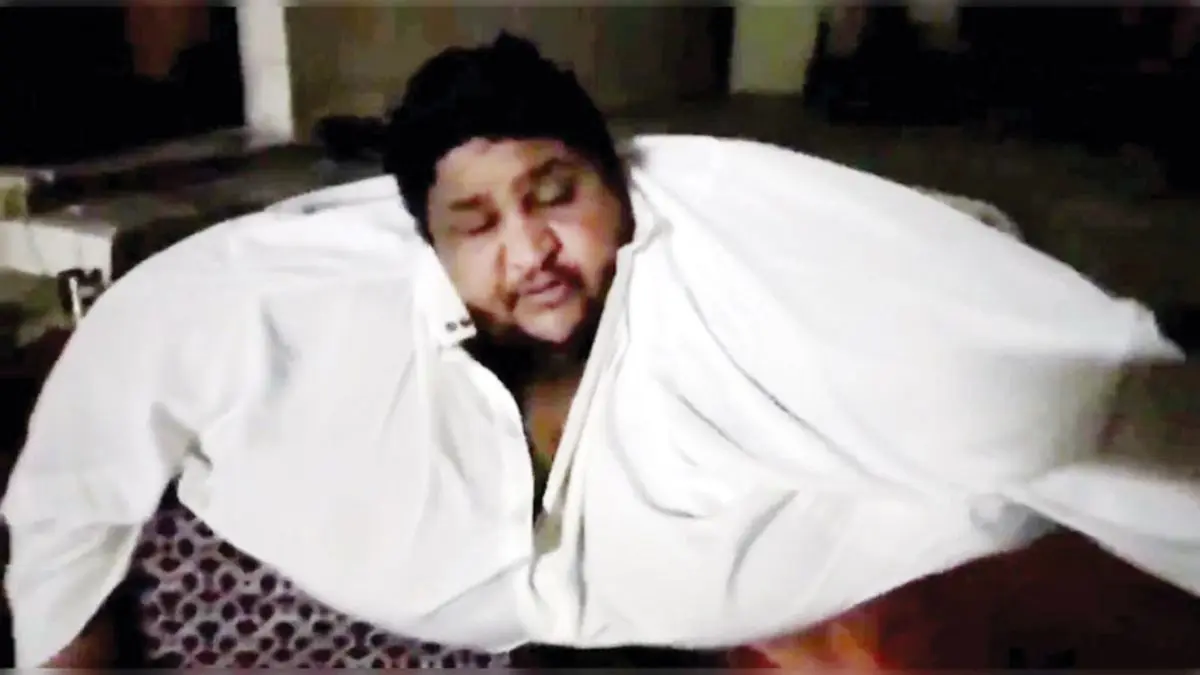 دور دنیا| مرد نیم‌ تنی عربستانی در بیمارستان بستری شد + ویدئو