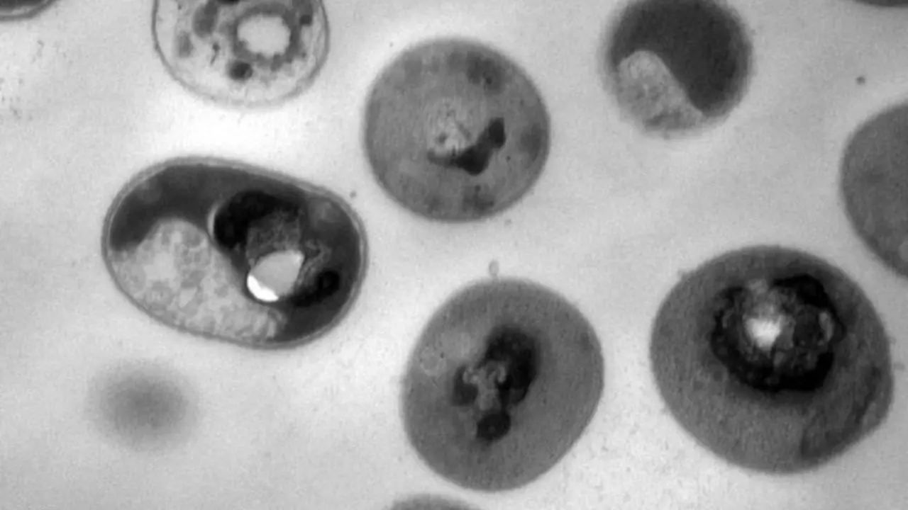 ثبت نخستین مرگ بر اثر ابتلا به ویروس خطرناک "ماربورگ" در آفریقا