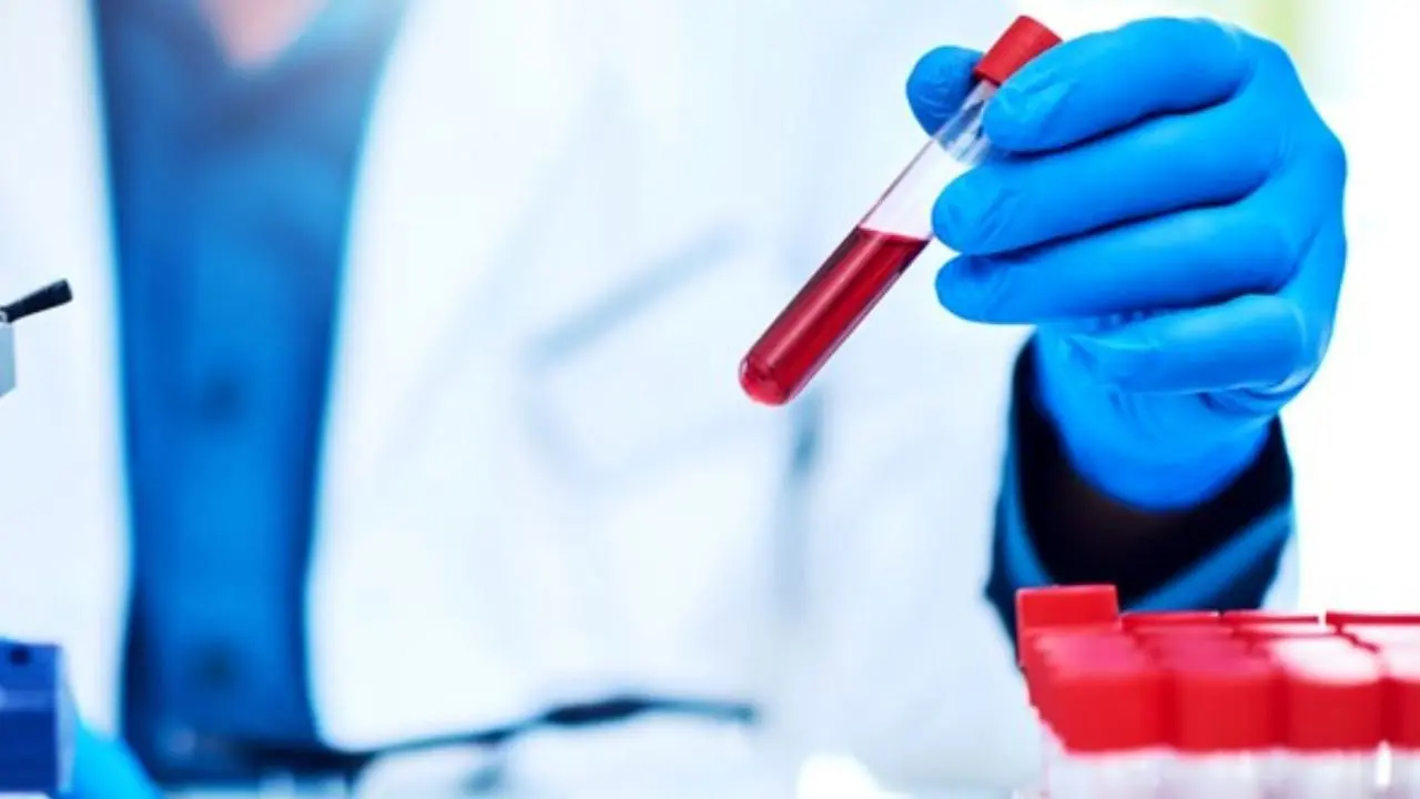 آغاز بزرگترین آزمایش جهانی "تست خون برای تشخیص 50 نوع سرطان"