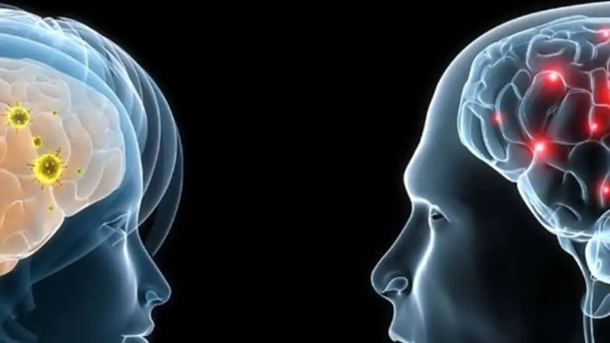 مغز «مردان» از زنان بزرگتر است/استفاده بیشتر «زنان» از دو نیمکره مغز