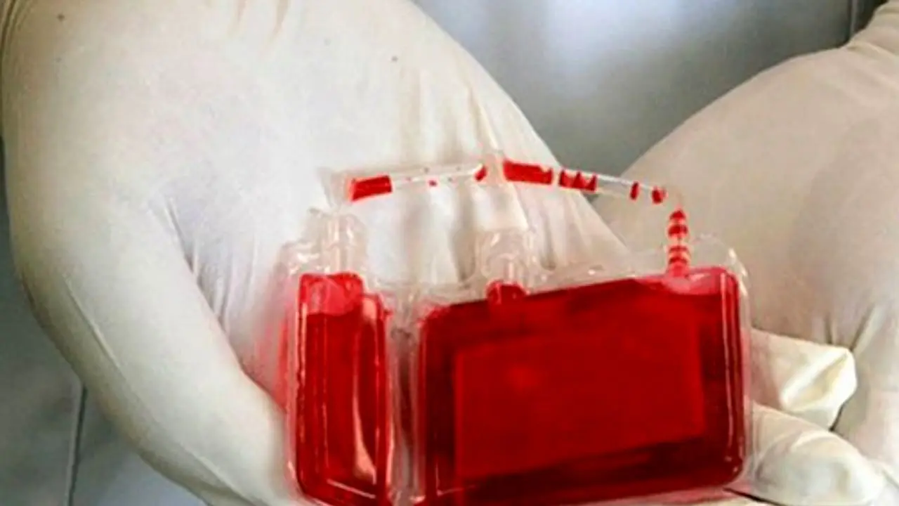 4150 واحد خون بند ناف در کشور ذخیره‌سازی شده است