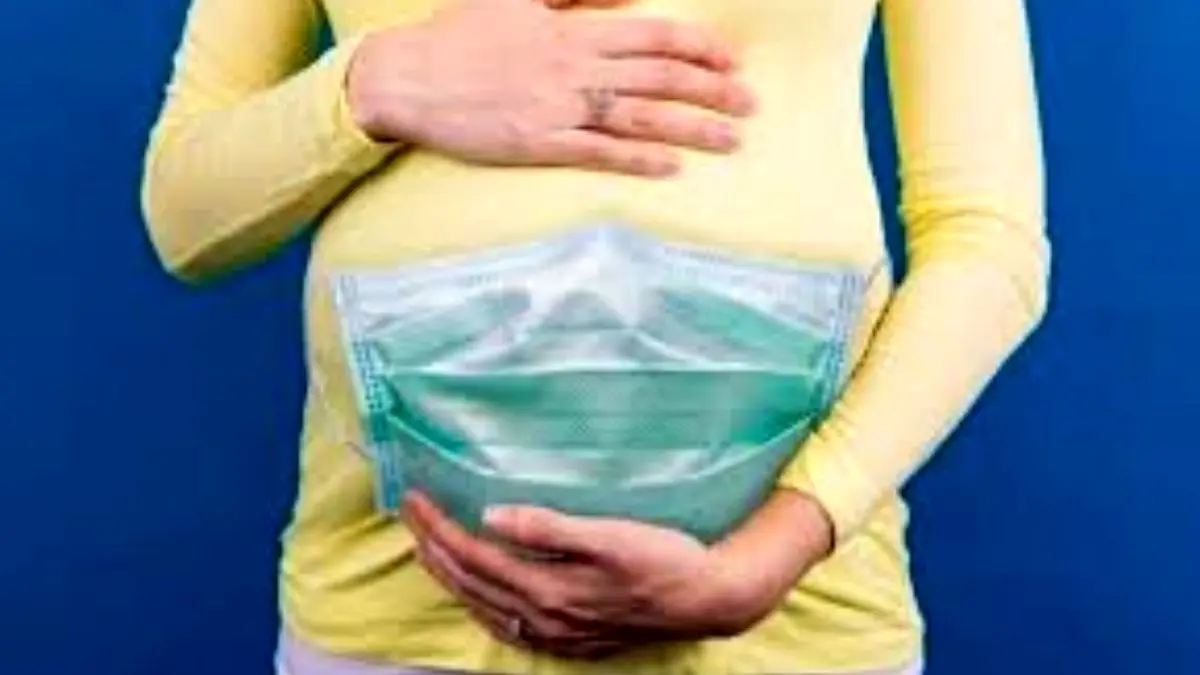احتمال مرده‌زایی در زنان باردار مبتلا به کووید-19 بیشتر است