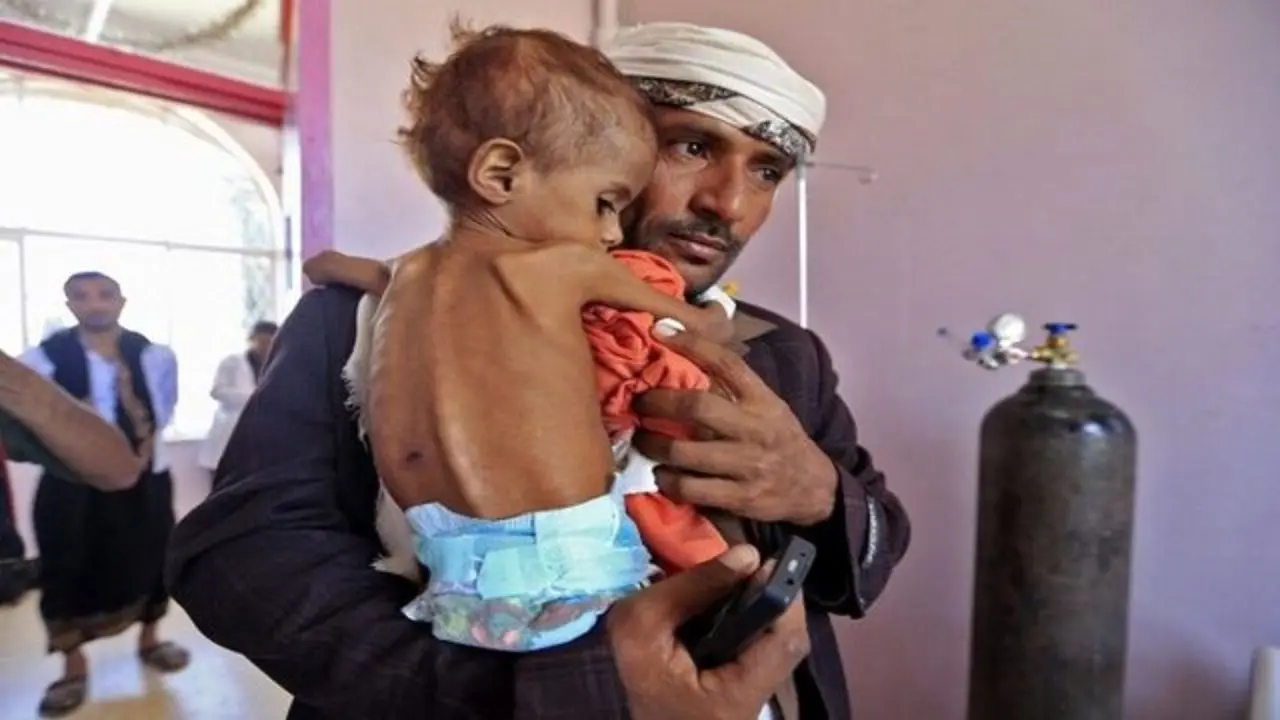 گرسنگی میلیون‌ها خانواده یمنی را تهدید می‌کند