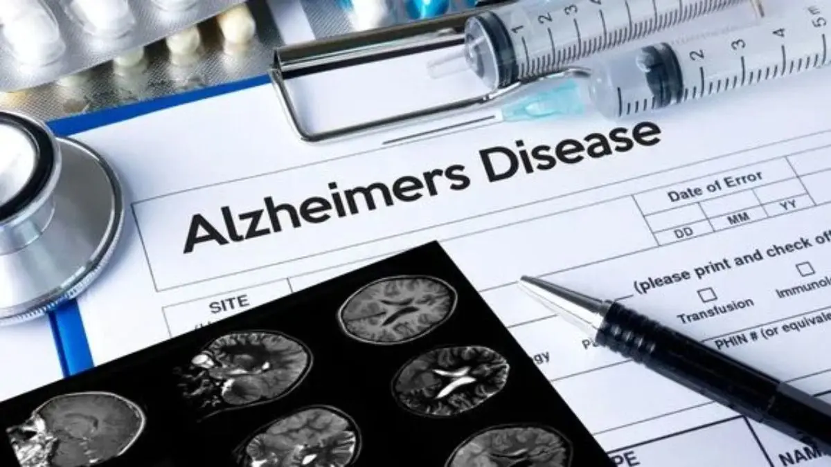 یک نسخه خوراکی برای پیشگیری از آلزایمر