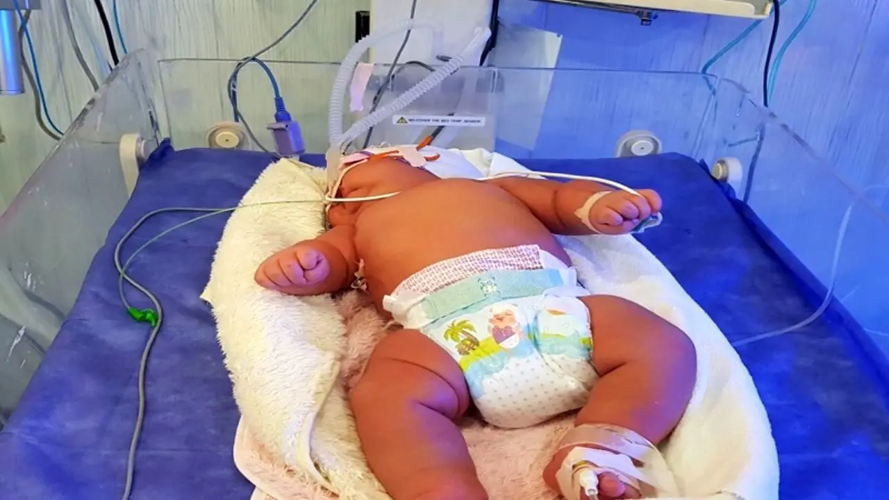 تولد سنگین‌ وزن‌ ترین نوزاد ایران در یزد