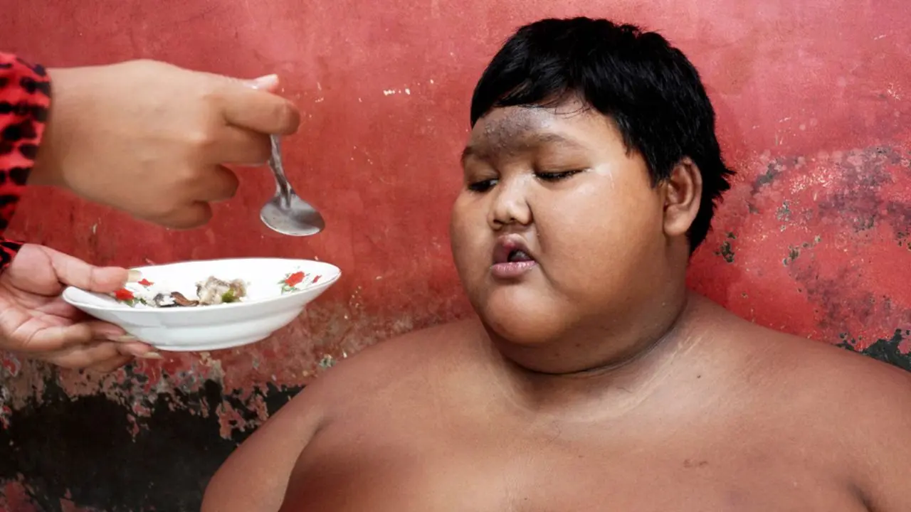 چاق‌ترین کودک جهان پس از لاغری + عکس