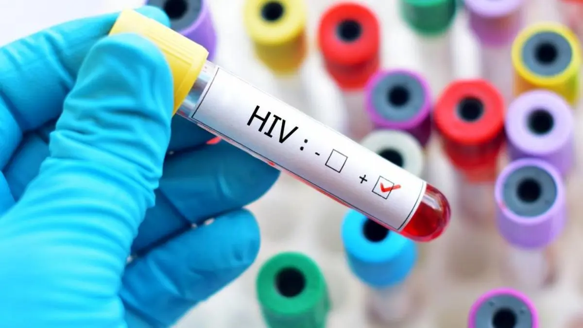 احداث بیمارستان مختص معتادان مبتلا به HIV
