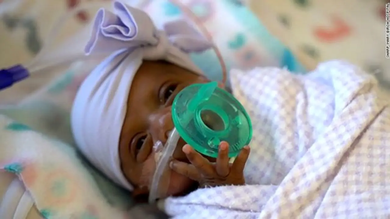 کوچک‌ترین نوزاد متولد شده جهان از بیمارستان مرخص شد