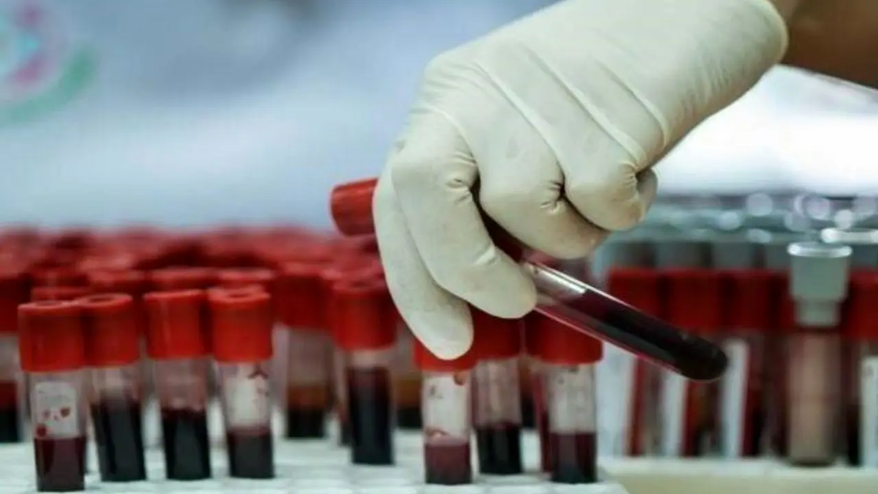 تاکید انتقال خون بر دسترسی به خون و محصولات خونی سالم