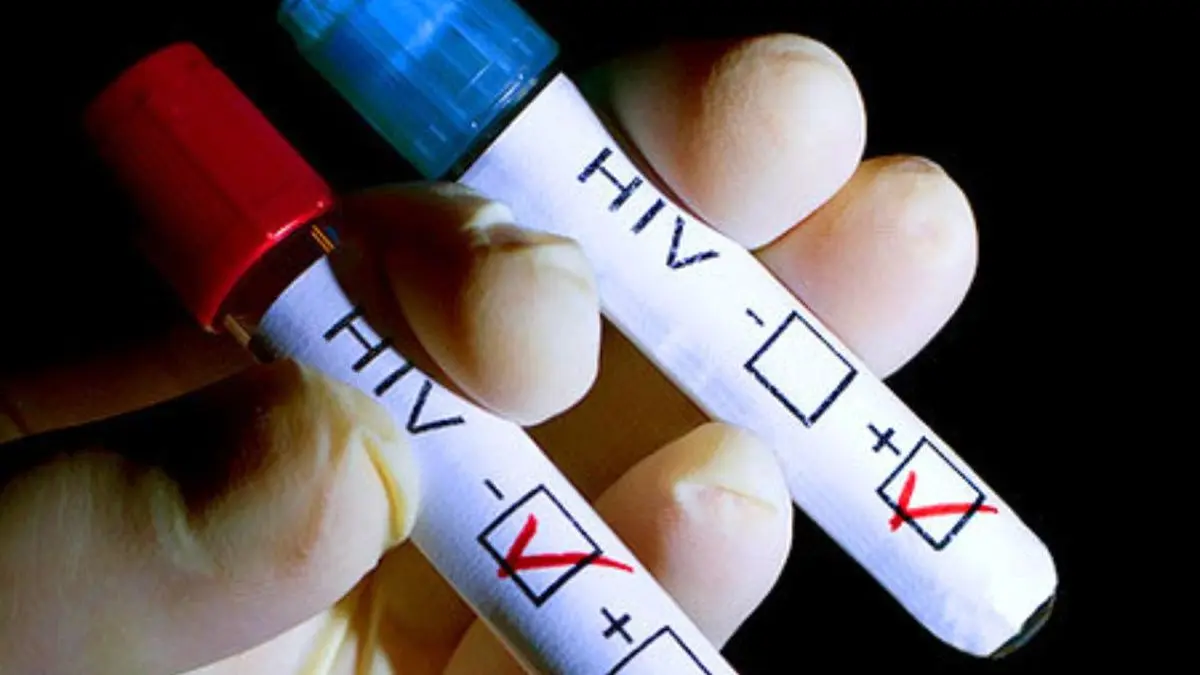مشاوره و آزمایش ایدز برای افراد در معرض خطر حیاتی است