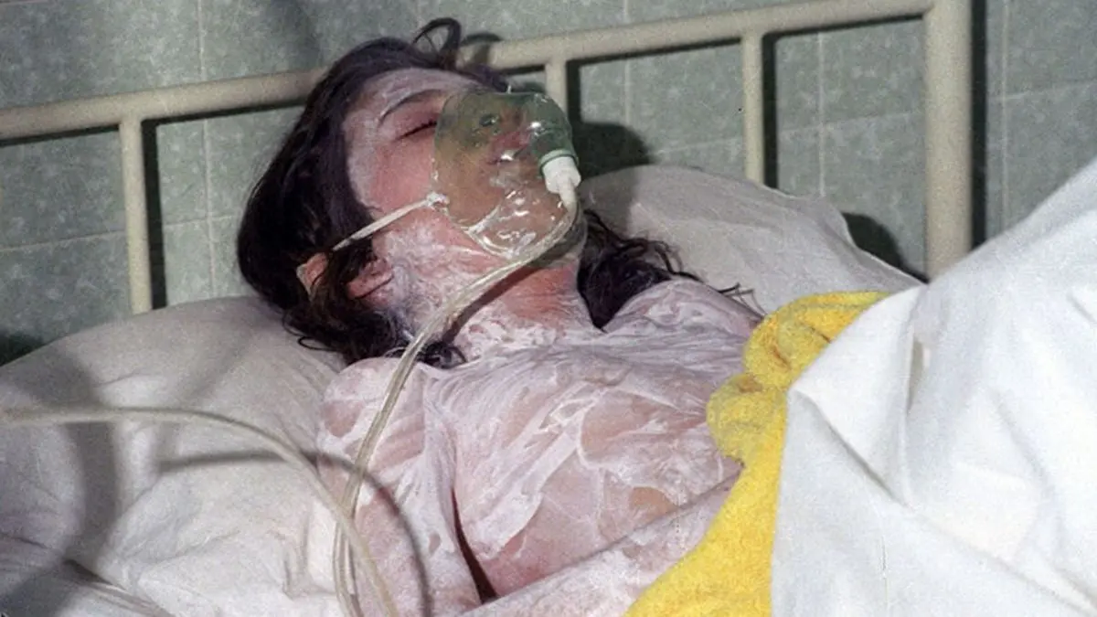 بلاتکلیفی وضعیت برخی از مصدومان شیمیایی سردشت بعد از 32 سال