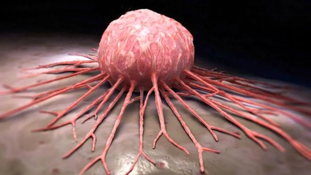 آیا دانشمندان پاشنه آشیل تومورهای سرطانی را کشف کردند؟
