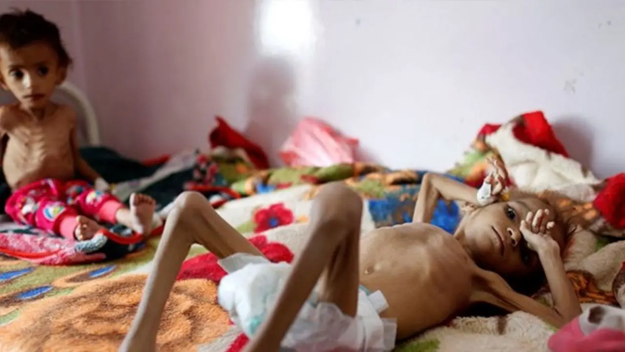 هر 10 دقیقه یک کودک یمنی می‌میرد