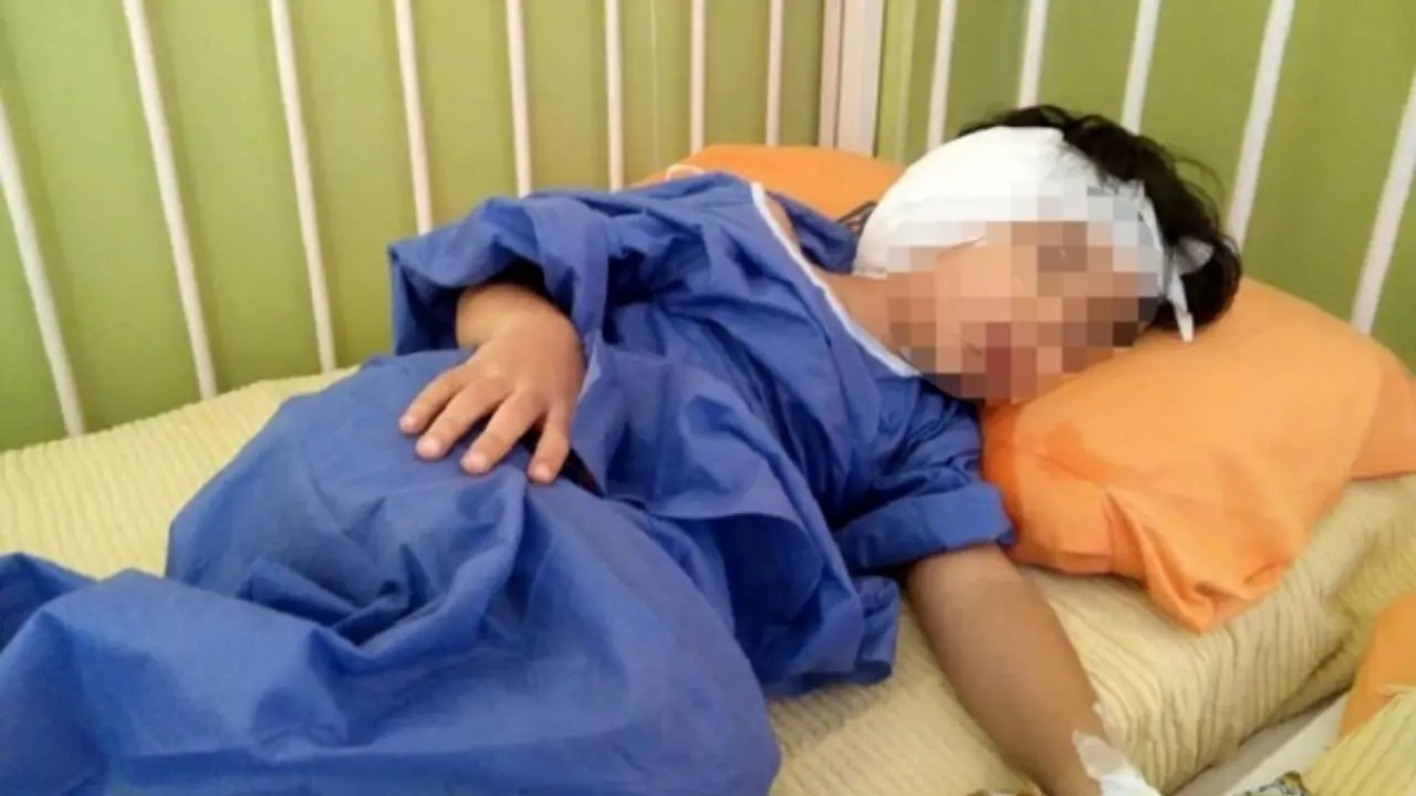 تائید قصور پزشکی در پارگی پرده گوش کودک 4 ساله