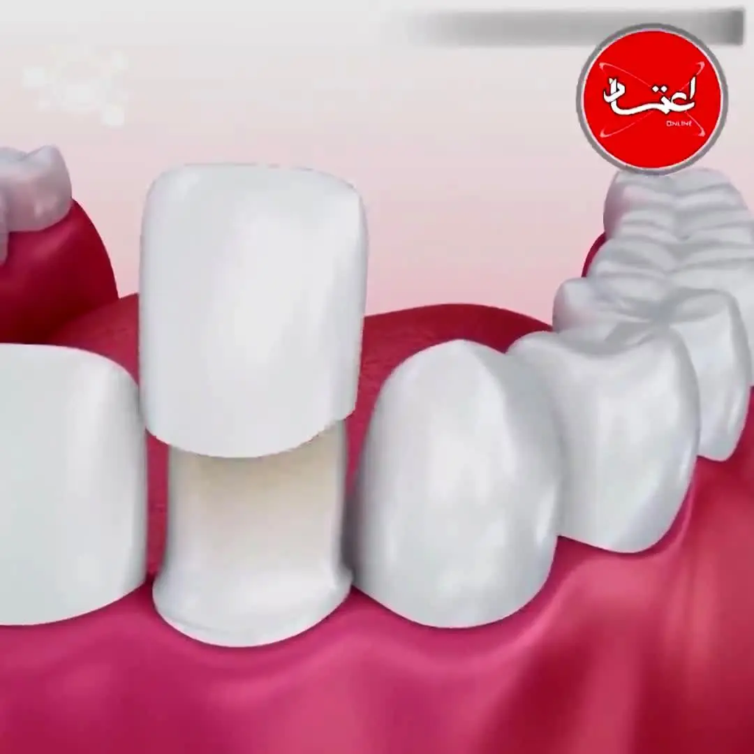 از کارهایی که دندانپزشک انجام می‌دهد چه می‌دانیم؟+ ویدئو