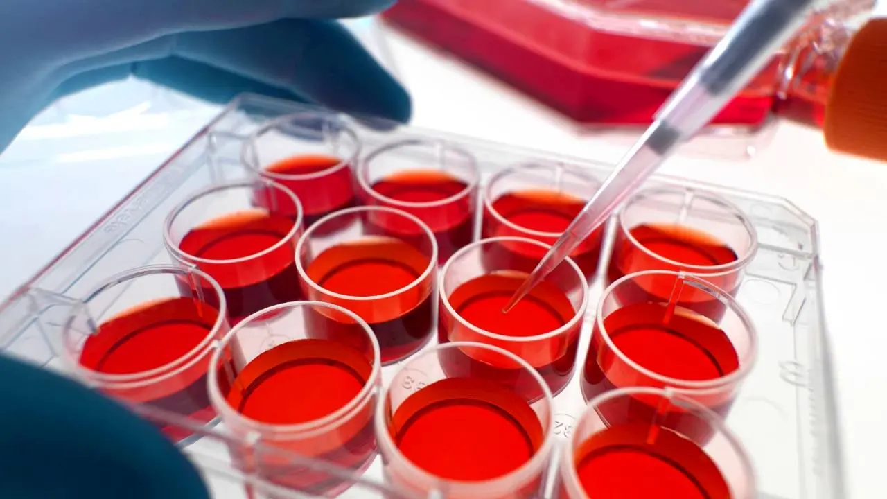ذخیره 4 هزار نمونه خون بند ناف در سازمان انتقال خون