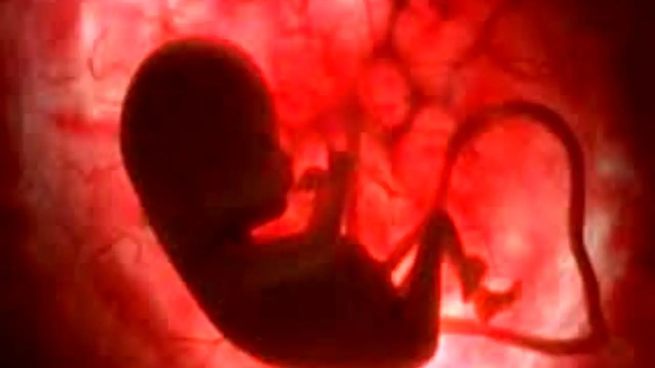 اطلاع ناکافی از قانون باعث زیرزمینی شدن سقط جنین می‌شود