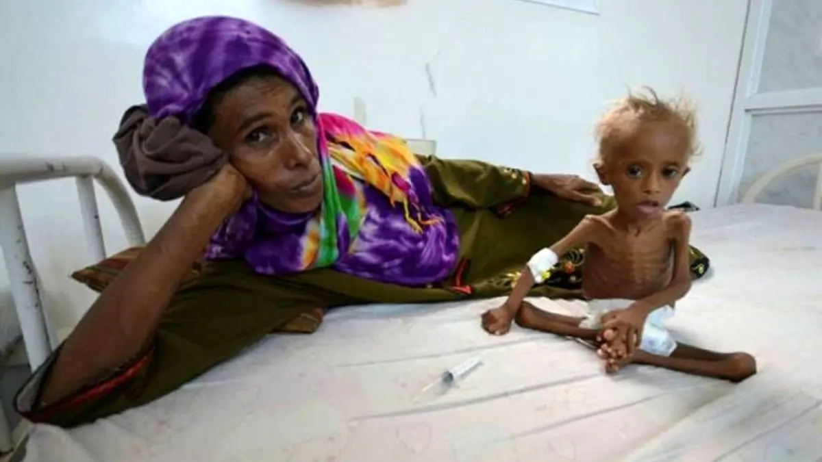 خطر مرگ، بیخ گوش کودکان یمنی/ سازمان بهداشت جهانی هشدار داد/ کمک‎های مالی کاهش یافته است