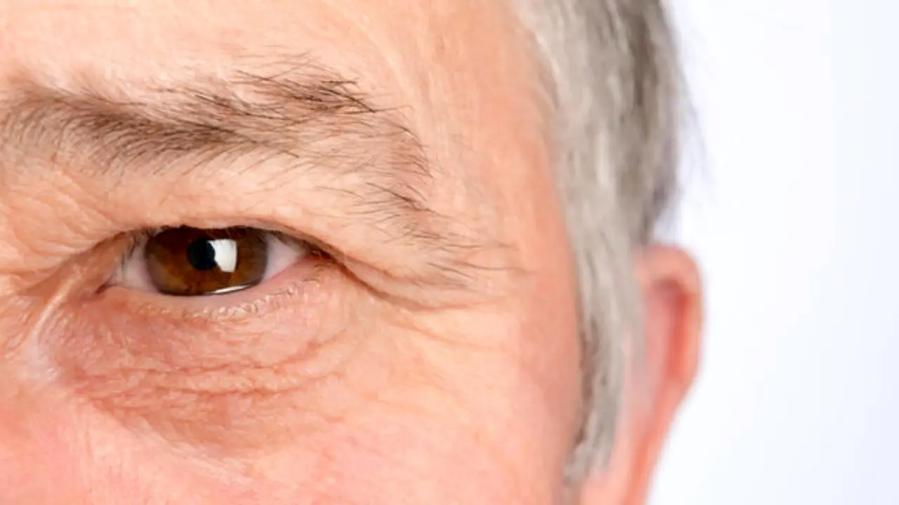 درمان خشکی چشم با قطره‌های حاوی پادتن
