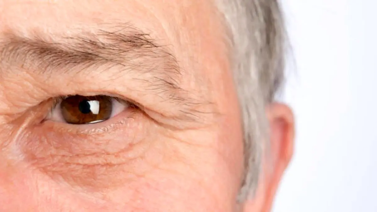 درمان خشکی چشم با قطره‌های حاوی پادتن