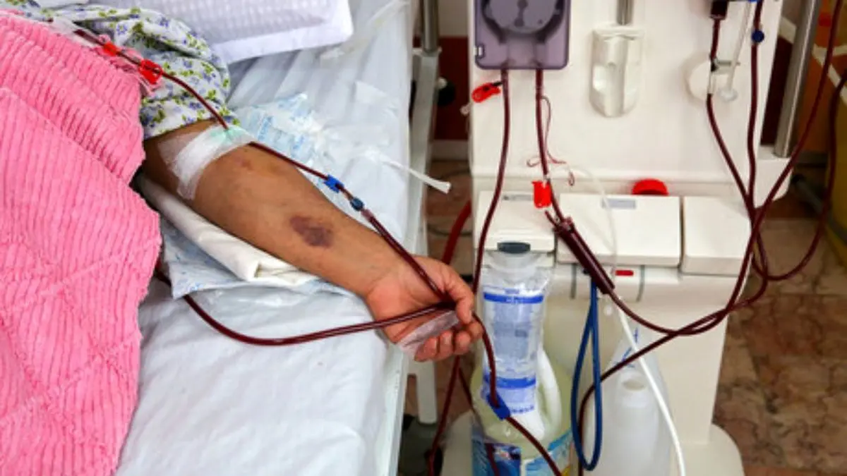 آمادگی هیات امنای صرفه‌جویی ارزی در معالجه بیماران برای تامین دستگاه‌های دیالیز سراسر کشور