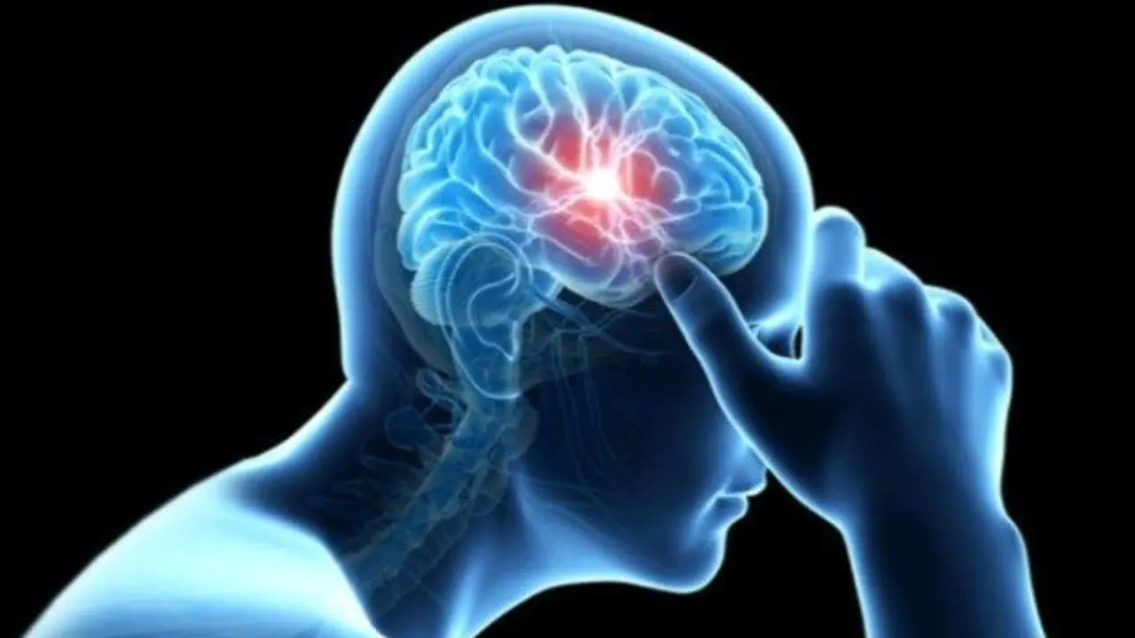 آسیب نخاعی با افزایش ریسک سکته مغزی مرتبط است