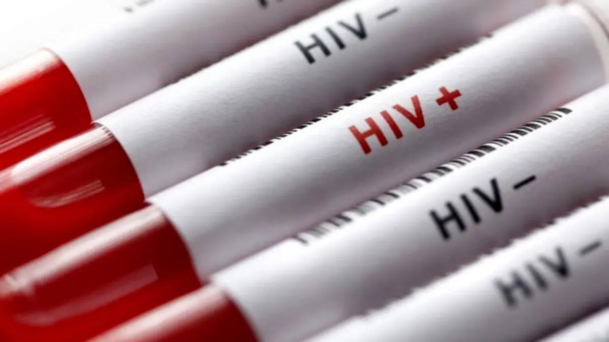 تغییر نسبت جنسیتی ابتلا به ایدز چه می‌گوید؟