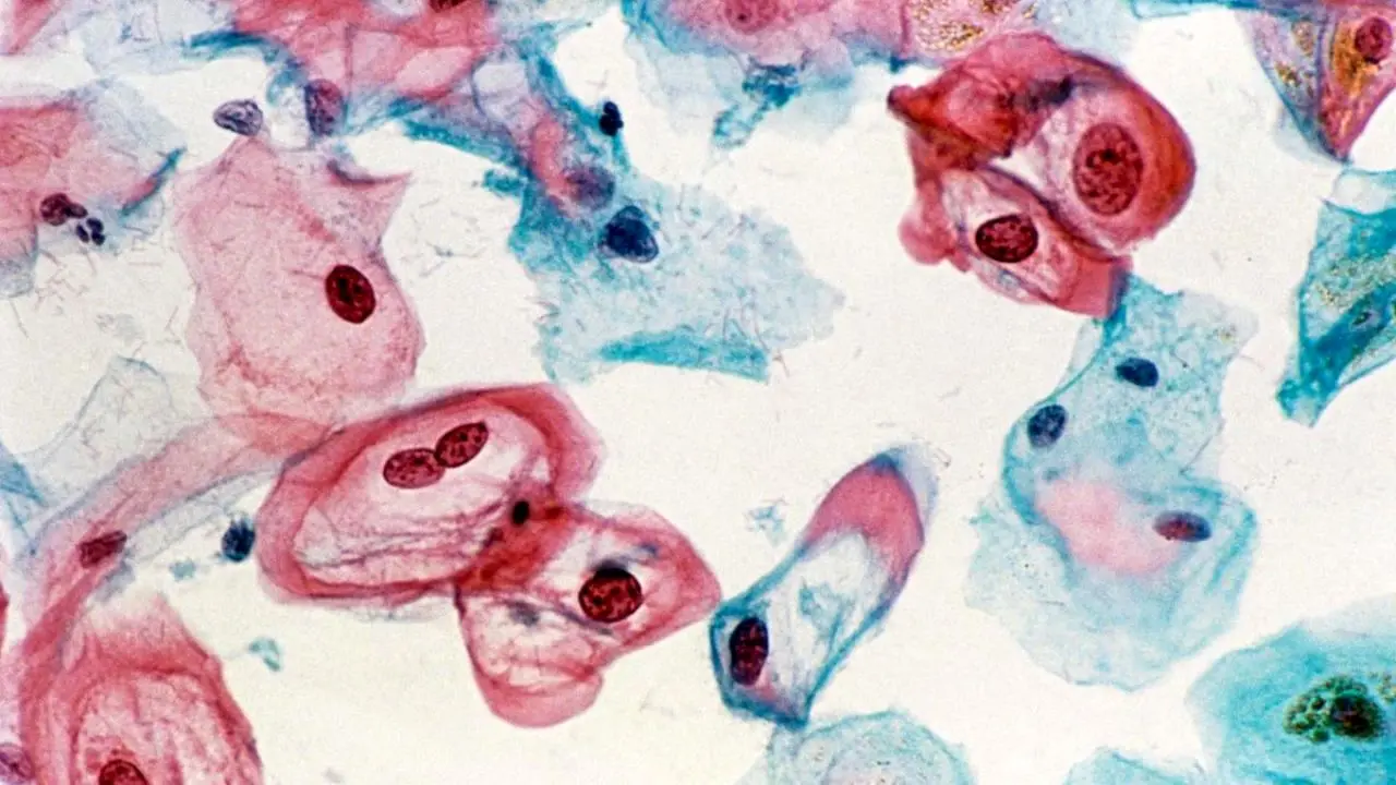 هشدارهای سرطان را بشناسیم