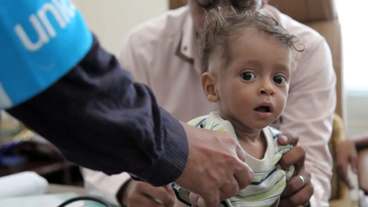 سازمان ملل انتقال 23 بیمار از صنعاء به اردن را لغو کرد