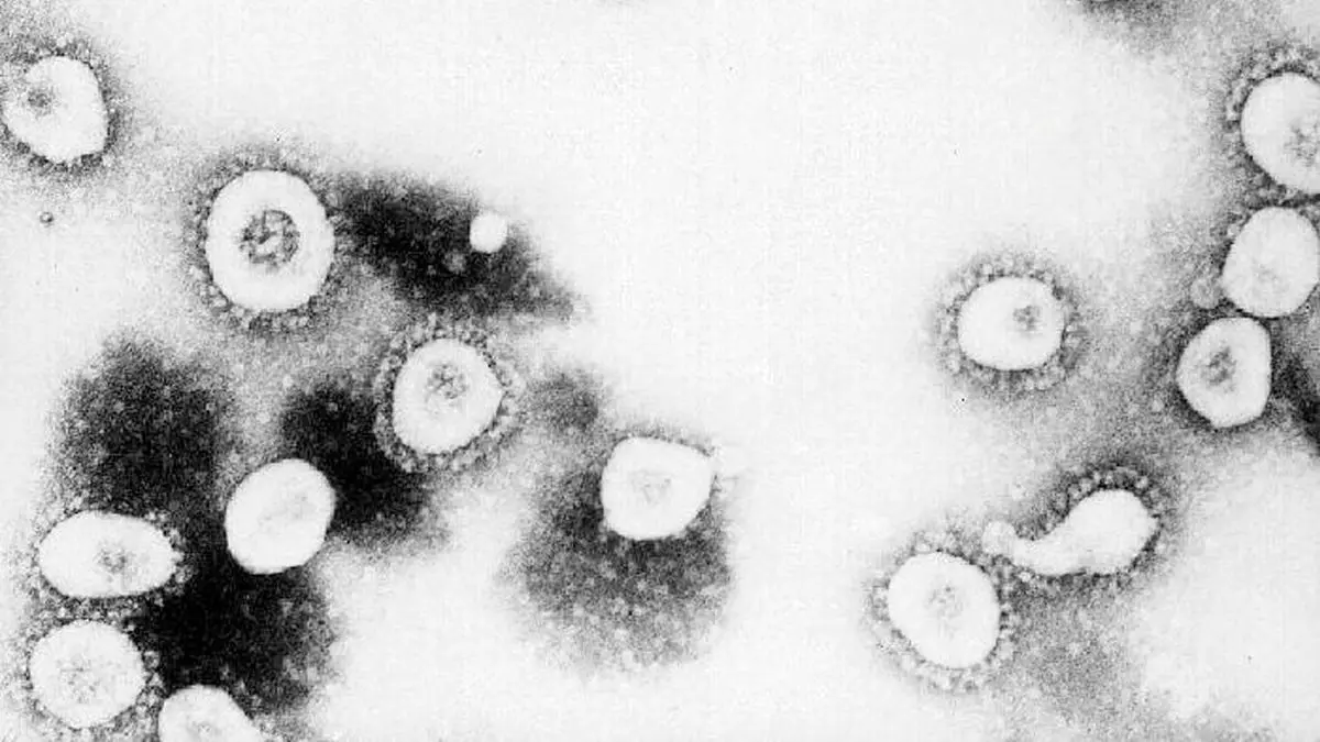 ویروس کرونا زیر میکروسکوپ چه شکلی است؟ + عکس