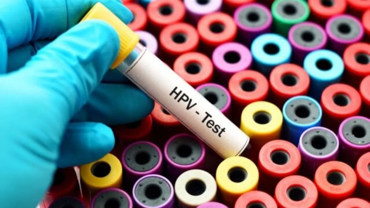 نرخ 5 تا 9 درصدی ابتلا به HPV در کشور/ تاثیر آلودگی هوا در فوت زودتر شهروندان