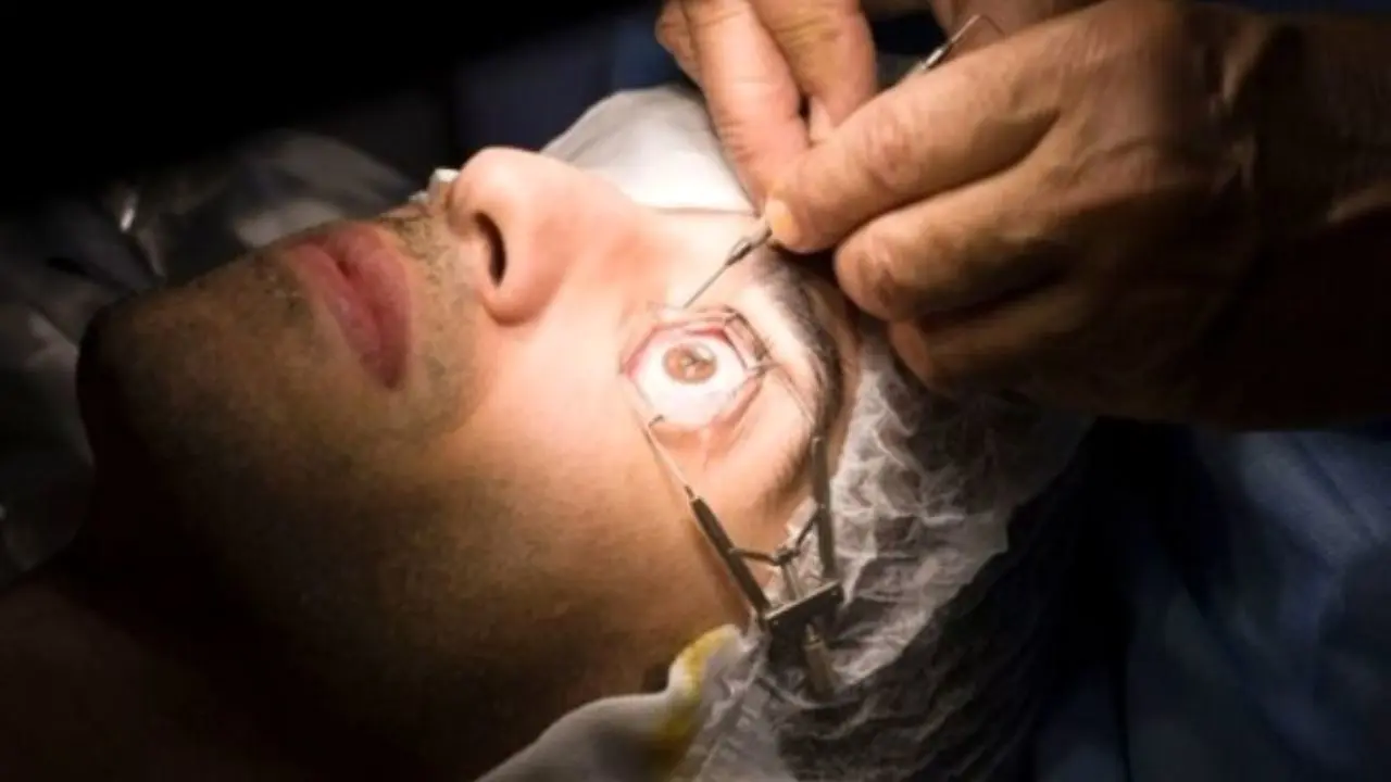 تولید چسب موقت ترومای چشمی/ جلوگیری از کوری در کمتر از یک دقیقه