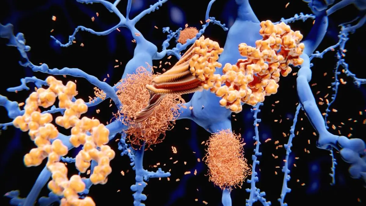 کدام سلول‌ها از مغز مقابل آلزایمر محافظت می‌کنند؟